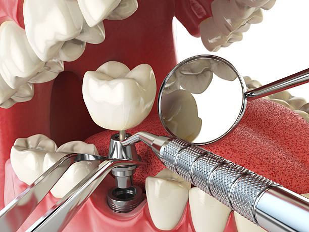 Best Emergency Treatment for Toothache in Brookfield Center, OH